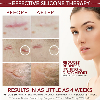 Physician Formulated Medical-Grade Silicone Scar Gel