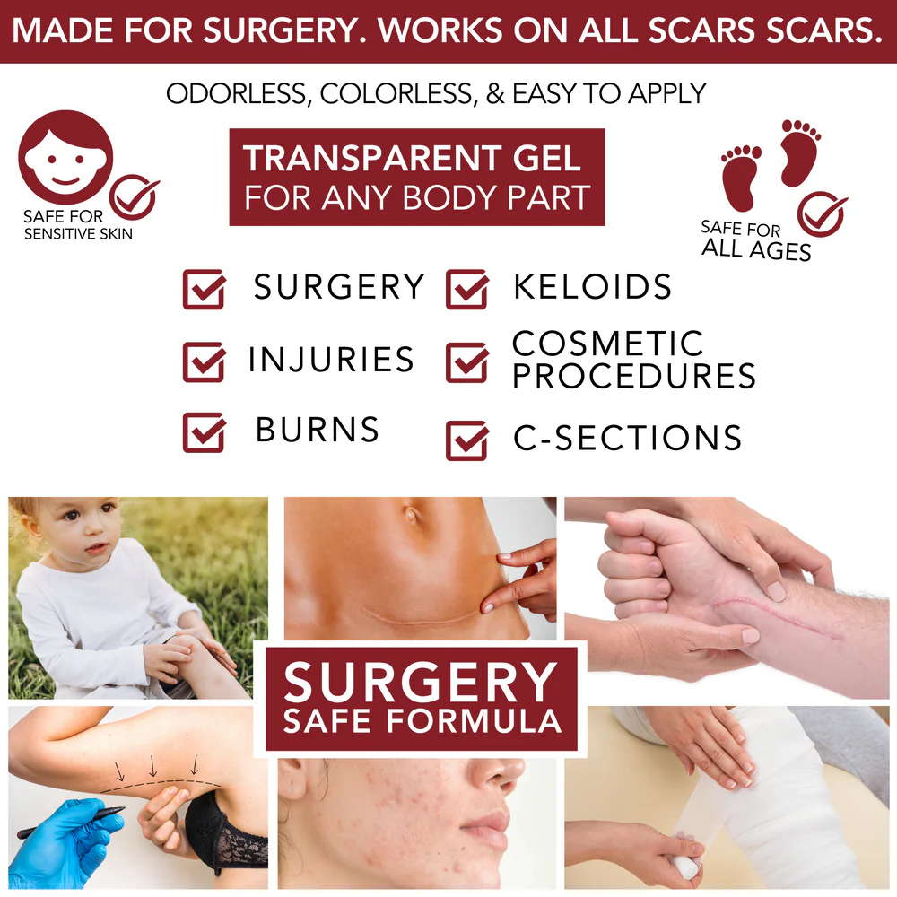 Physician Formulated Medical-Grade Silicone Scar Gel